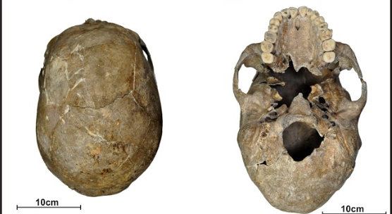 CAHID reveal some of the mysteries of 9,000-year-old decapitation