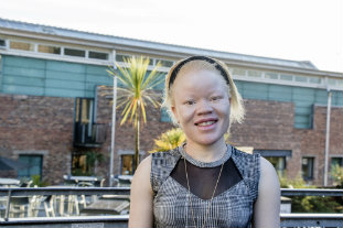 Albinism campaigner speaks of being hunted for body parts